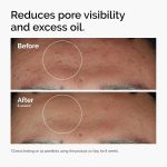 The Ordinary Niacinamide 10% + Zinc 1% Serum – 30ml - Image 5