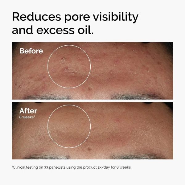 The Ordinary Niacinamide 10% + Zinc 1% Serum – 30ml - Image 5